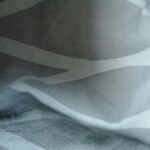 Anoym2401