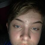 PG18