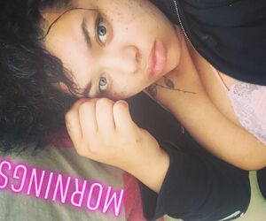 Freckles
