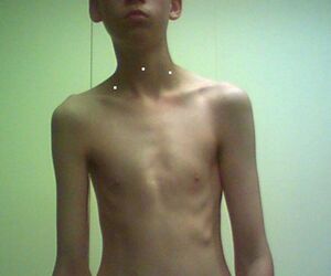 Skyler