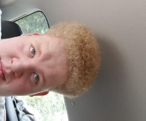 Albinoiblackki