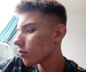 tomek
